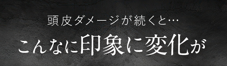 頭皮ダメージが続くと…こんなに印象に変化が