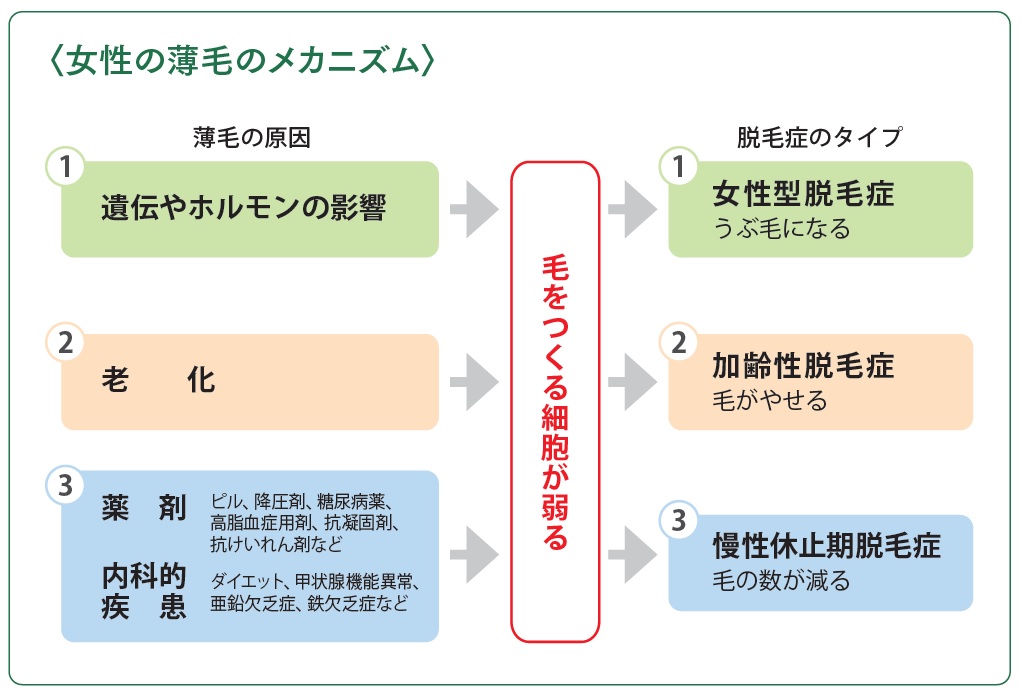 女性の薄毛パターン