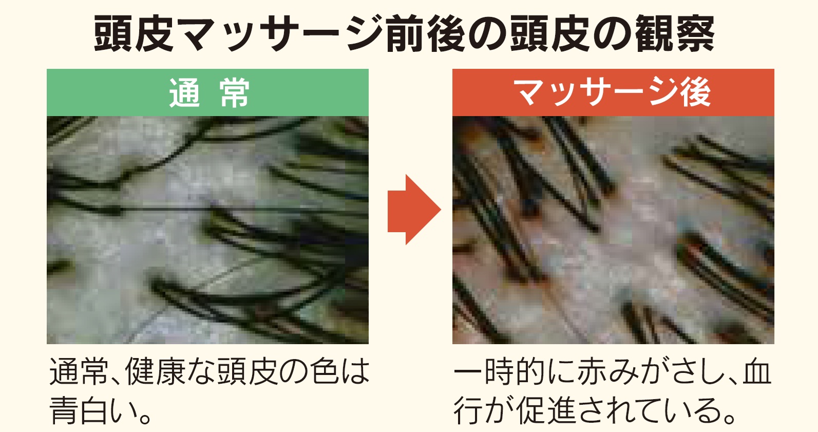 頭皮マッサージ前後の頭皮の観察